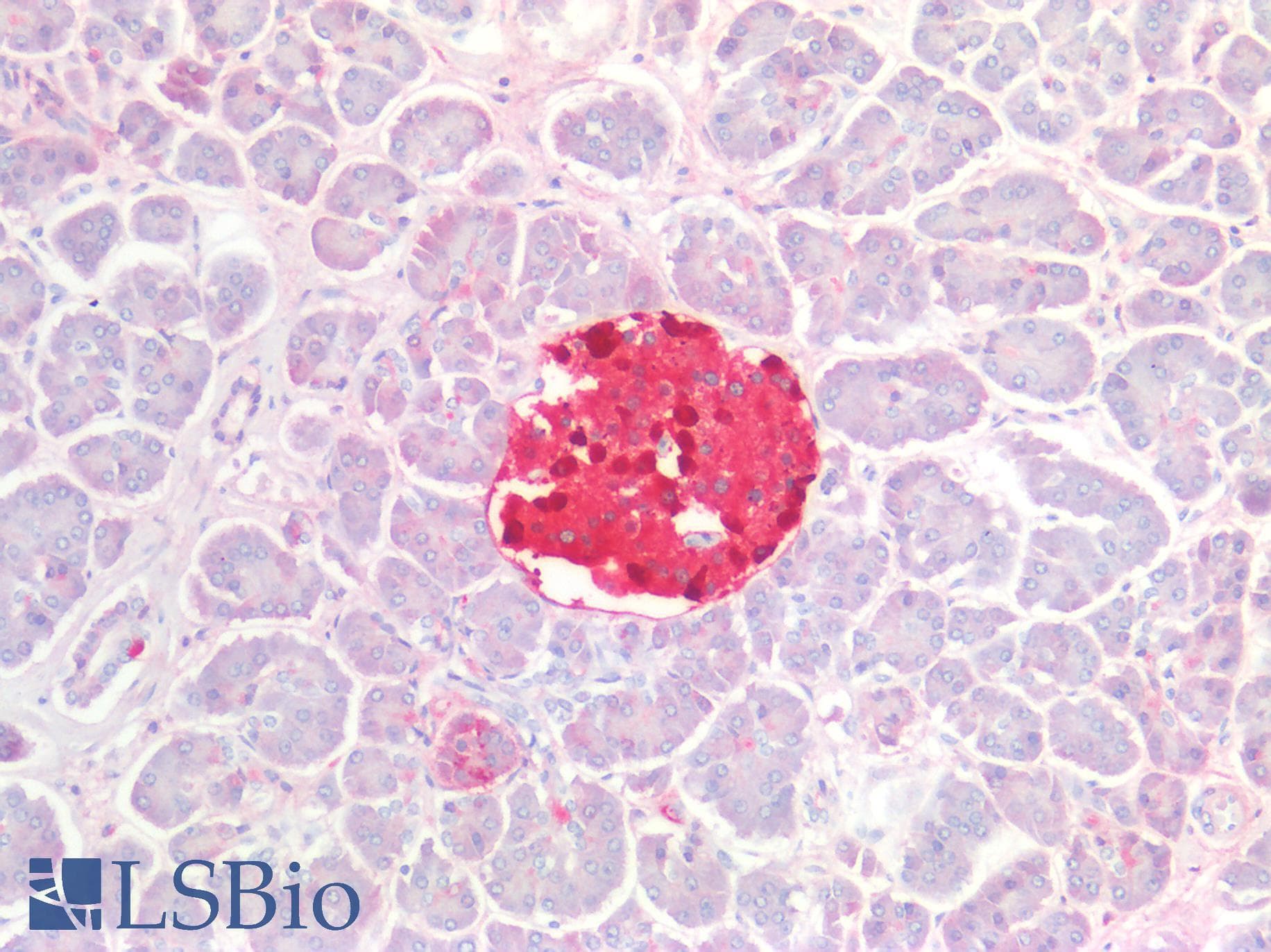 IHC-plus™ TTR / Transthyretin Antibody