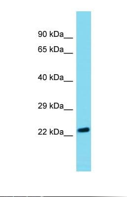 ARHGDIB / D4 GDI Antibody (N-Terminus)