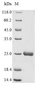 Avena sativa Endochitinase Protein (Recombinant 6His, N-terminus)