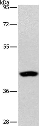 PHYKPL / AGXT2L2 Antibody