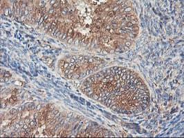 TUBAL3 Antibody (clone OTI1C2)