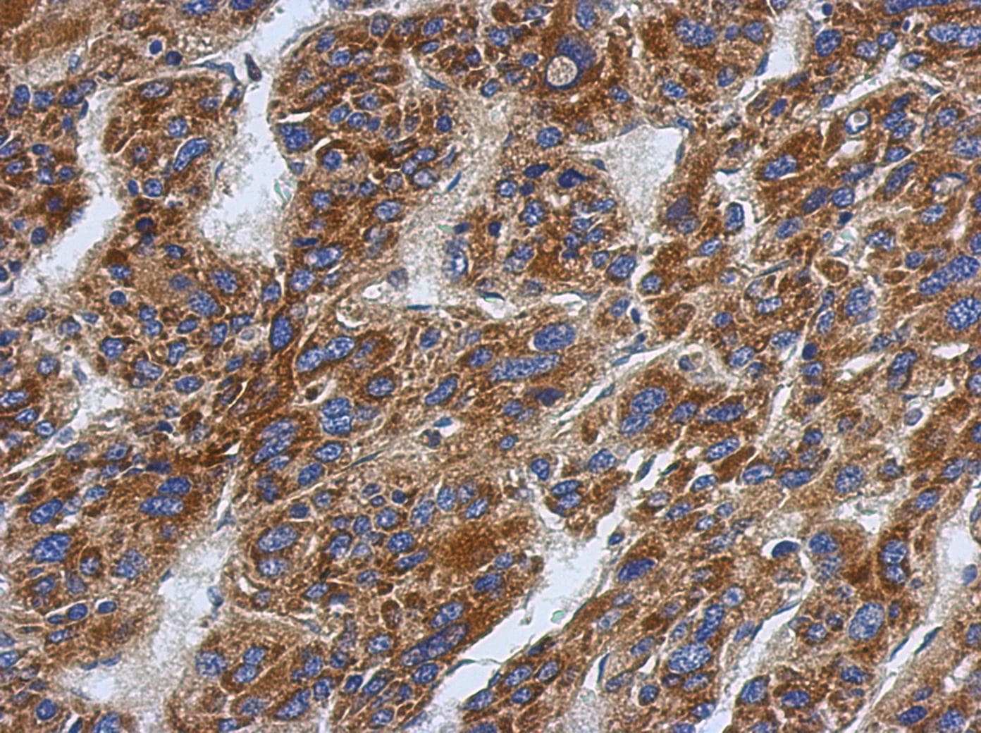 SFXN1 Antibody