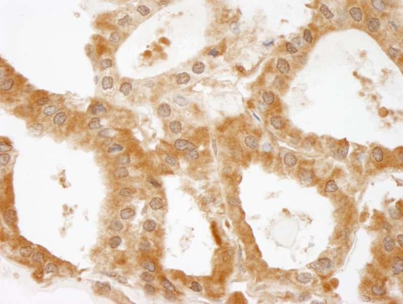 CC2D1A Antibody (aa1-50)