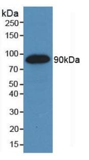 KDR / VEGFR2 / FLK1 Antibody