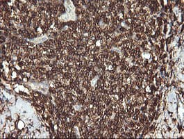 CD45 / LCA Antibody (clone OTI3D8, Carrier-free)