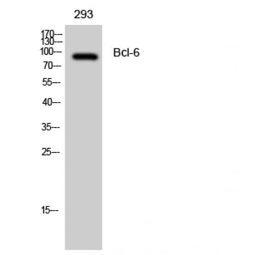Polyclonal Rabbit anti-Human BCL6 Antibody (270-350 aa, IHC, WB)