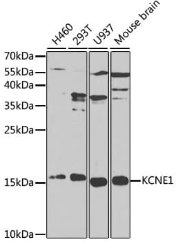 Polyclonal Rabbit anti-Human KCNE1 / MinK Antibody (IHC, WB)