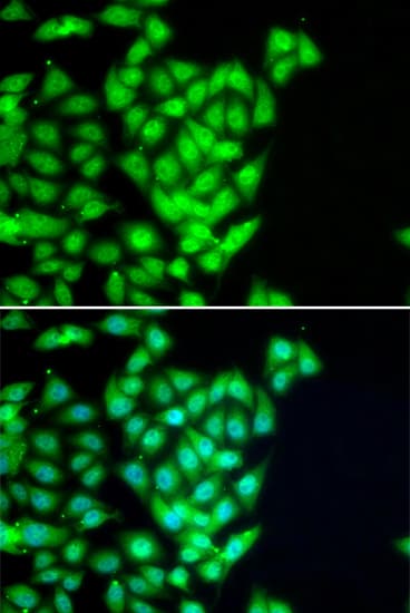 RAD51B Antibody