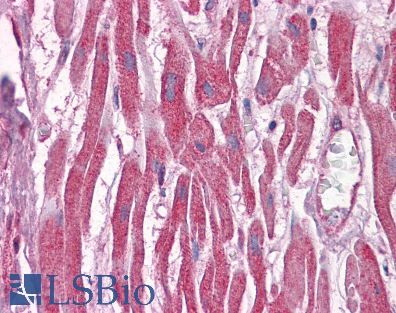 IHC-plus™ DUSP6 / MKP3 Antibody (clone 3G2)