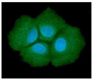 ADSL / Adenylosuccinate Lyase Antibody (clone AT16C10)