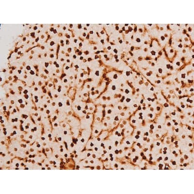 Polyclonal Rabbit anti-Human SYK Antibody (phospho-Tyr348, IHC, IF, WB)