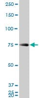 IHC-plus™ HNRPM / HNRNPM Antibody (clone 3F7)
