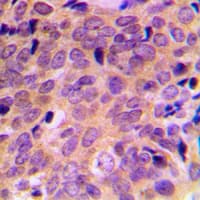 ATF4 Antibody (Internal)