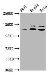 MLK4 / KIAA1804 Antibody