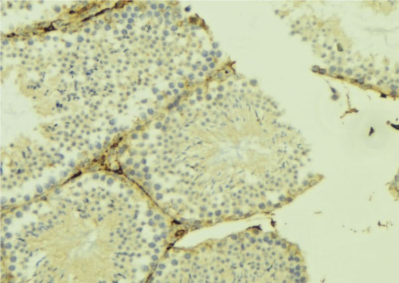 B4GALT3 Antibody