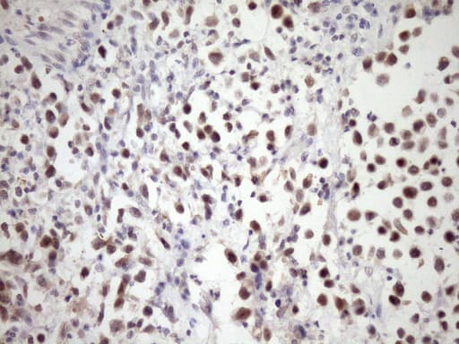 Monoclonal Mouse anti-Human SNRPB2 Antibody (clone OTI3D9, Carrier-free, IHC, WB)