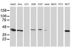 ARFGAP1 Antibody (clone OTI1H6)