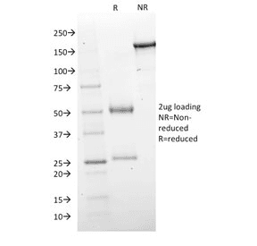 GAD1 / GAD67 Antibody (clone GAD1/2563)