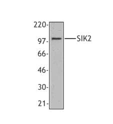 IHC-plus™ SIK2 / SNF1LK2 Antibody (clone S15G10)