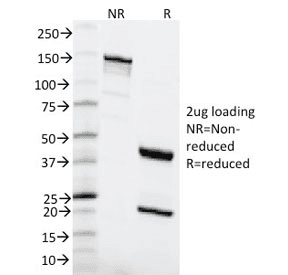 Monoclonal Mouse anti-Human MSH6 Antibody (clone MSH6/2111, Azide-free,BSA-free, WB)