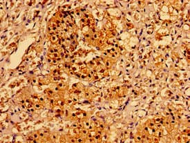 Polyclonal Rabbit anti-Human AAGAB Antibody (IHC, IF)