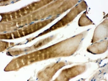 Polyclonal Rabbit anti-Human MAP2K3 / MEK3 / MKK3 Antibody (IHC, WB)