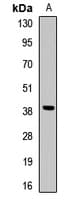 PathPlus™ ELAVL2 / HUB Antibody