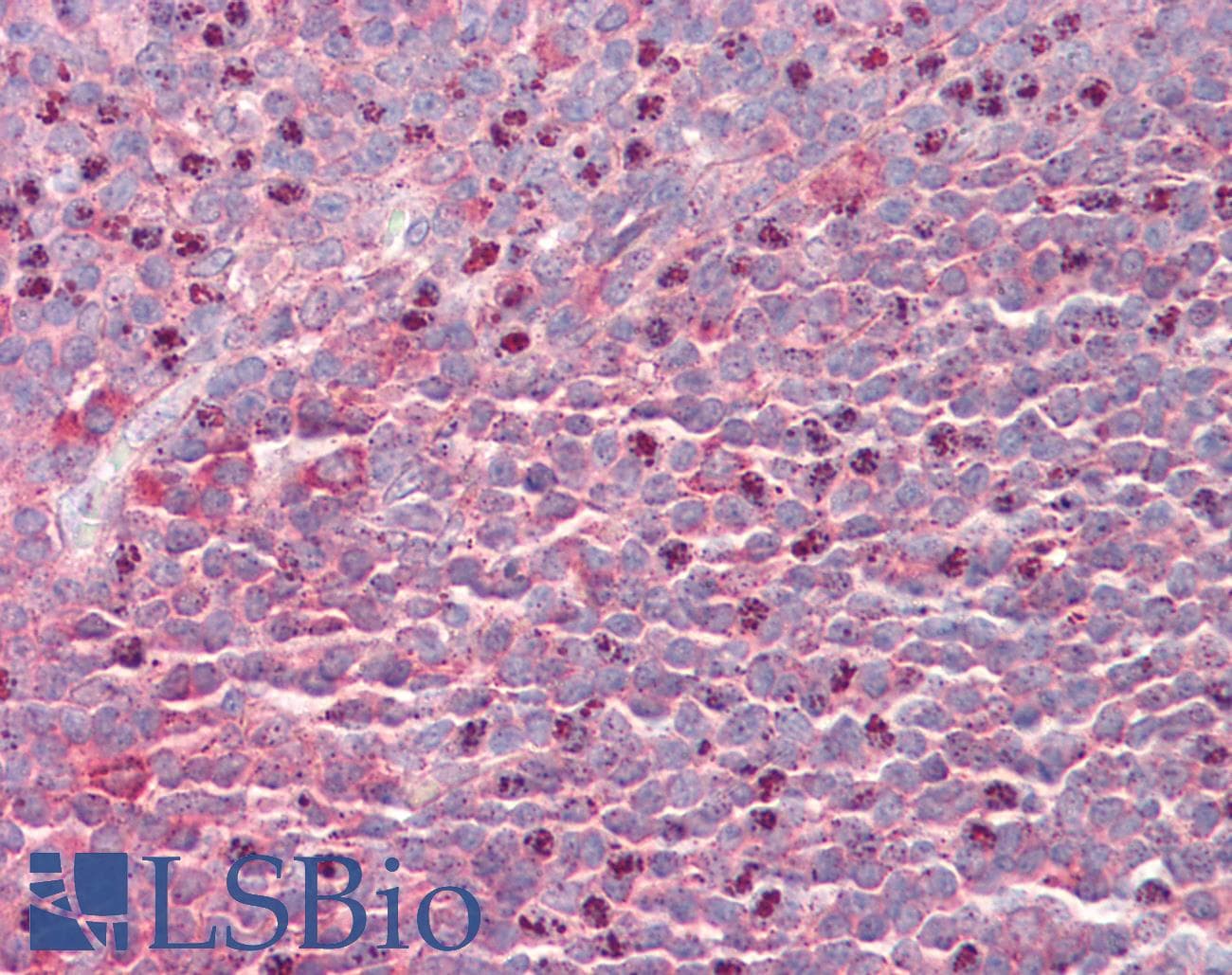 IHC-plus™ Polyclonal Goat anti-Human SEPT6 / Septin 6 Antibody (aa523-534, IHC, WB)