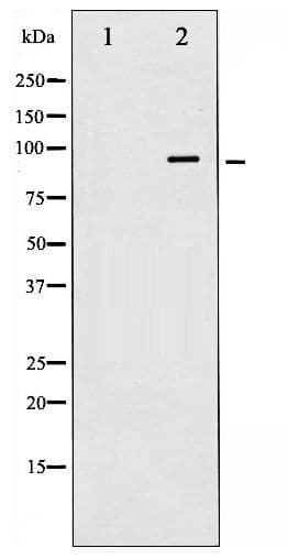 INSR / Insulin Receptor Antibody (phospho-Tyr1361)