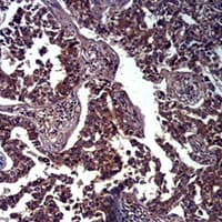 CDH1 / E Cadherin Antibody
