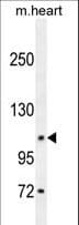 DAGLA Antibody (aa317-345)