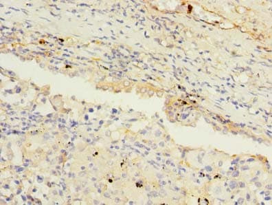 MAGEA9 Antibody