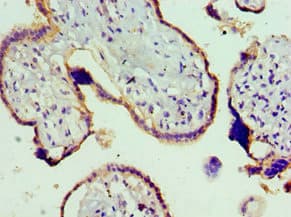 TRPM8 Antibody