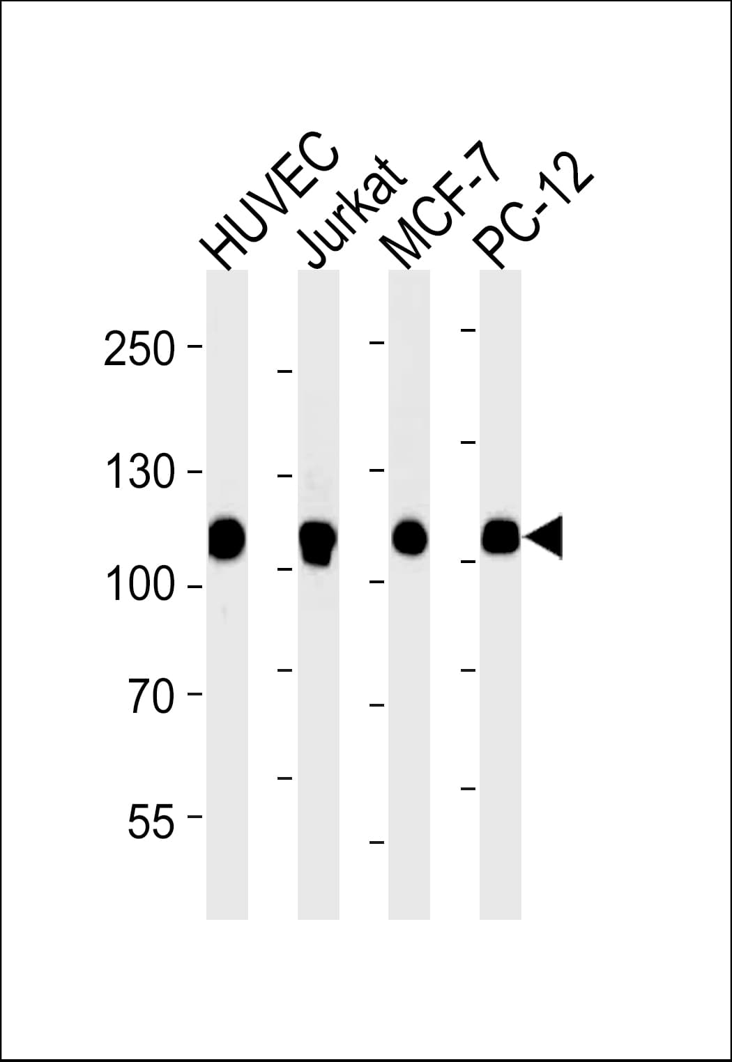 TOP1 / Topoisomerase I Antibody (N-Terminus, clone 1291CT875.142.166)