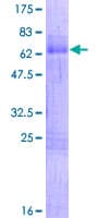 Human CRD / CRX Protein (Recombinant GST)