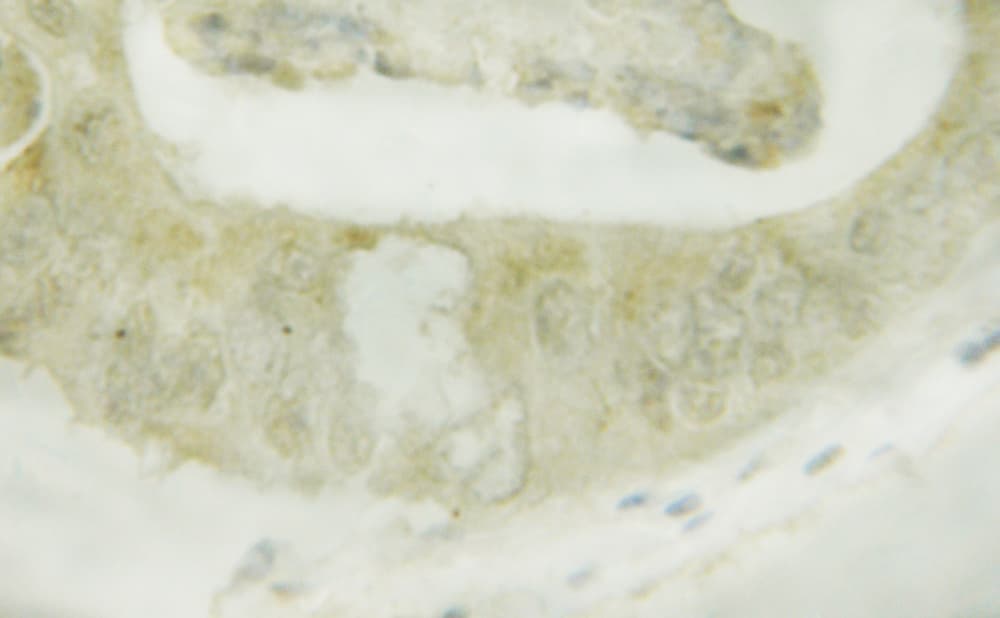 Polyclonal Rabbit anti-Human STK11 / LKB1 Antibody (phospho-Ser428, IHC, IF, WB)