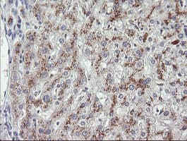 MDM4 / MDMX Antibody (clone OTI2D11)