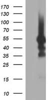 TUBB1 / Tubulin Beta 1 Antibody (clone OTI1G5, Carrier-free)
