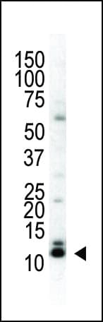 IHC-plus™ SUMO2 + SUMO3 Antibody (aa49-81)