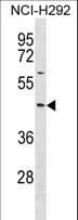 TXNIP Antibody (aa1-30)