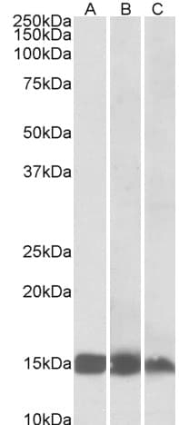 IHC-plus™ FABP3 / H-FABP Antibody (aa39-53)