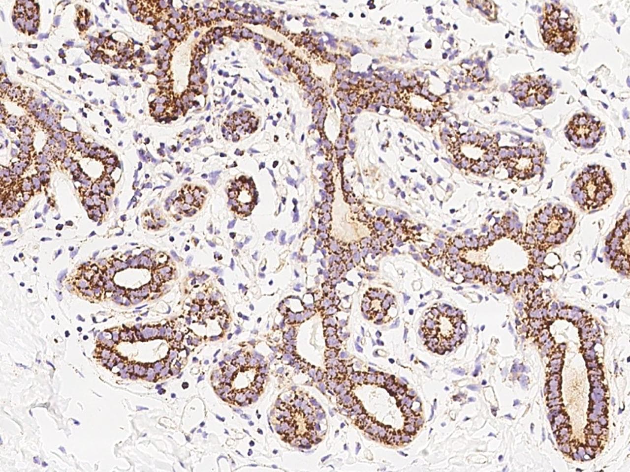 Polyclonal Rabbit anti-Human VEGF 121 Antibody (Preservative Free, IHC, IF)