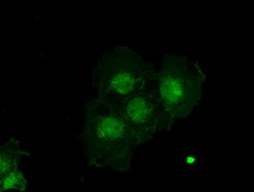 Alpha-Fetoprotein Antibody (aa19-397, clone OTI4G9)