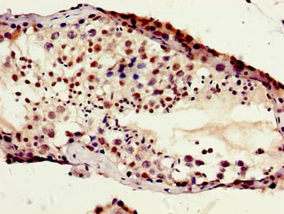HIST1H1B Antibody