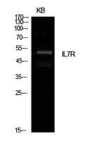IL7R / CD127 Antibody
