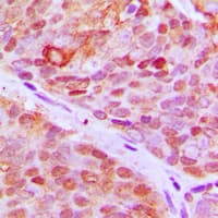 Polyclonal Rabbit anti-Human ZNF148 / ZBP-89 Antibody (N-Terminus, IHC, IF, WB)