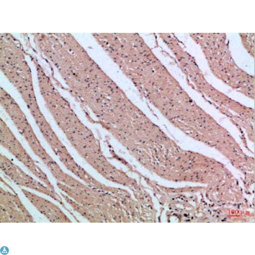 PIK3R2 / p85 Beta Antibody