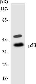 TP53 / p53 Antibody (aa322-371)