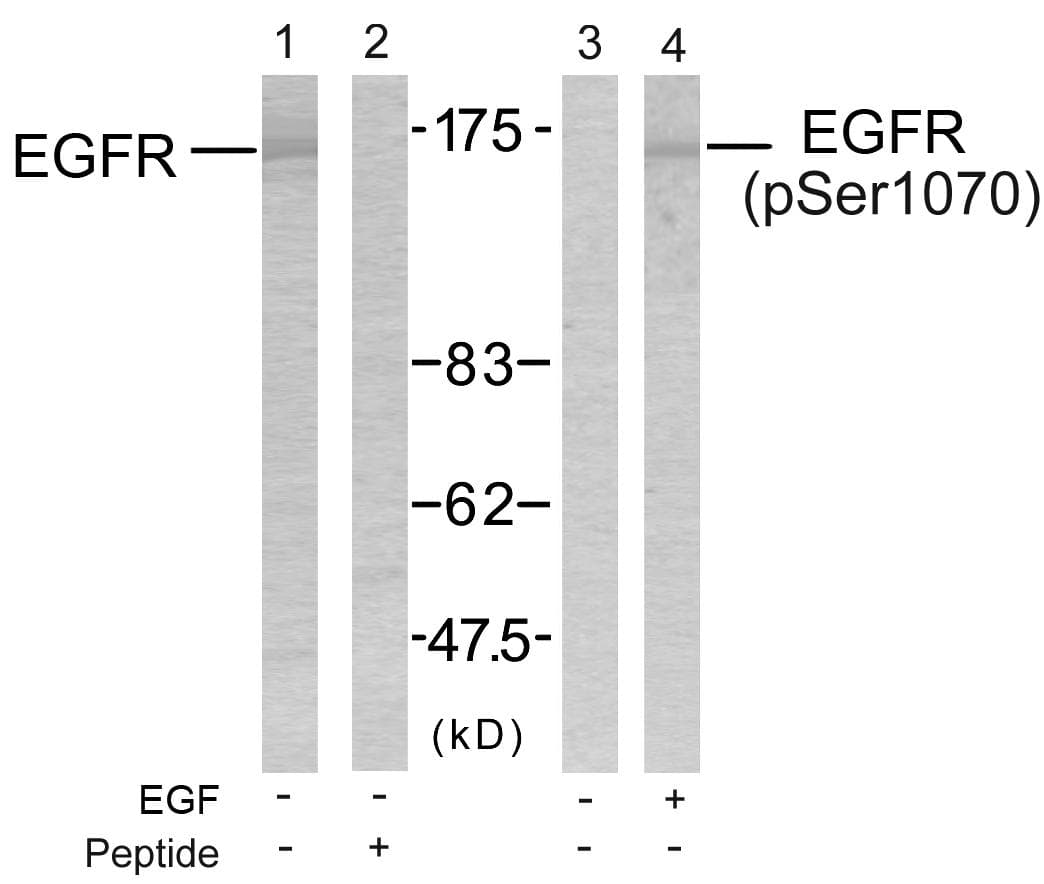 EGFR Antibody (phospho-Ser1070)