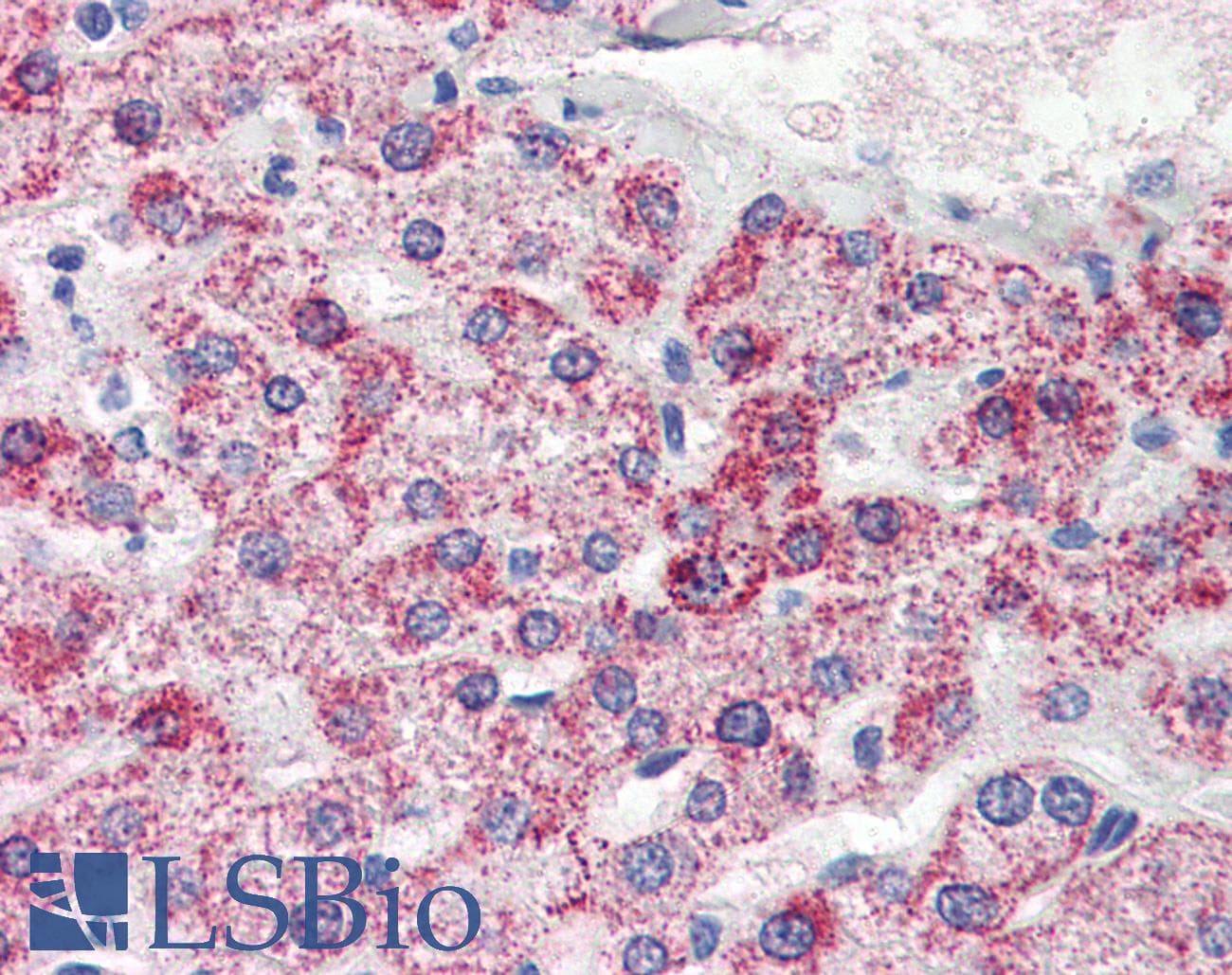 IHC-plus™ Monoclonal Mouse anti-Human PSPH Antibody (clone 3G12, aa1-225, IHC, WB)